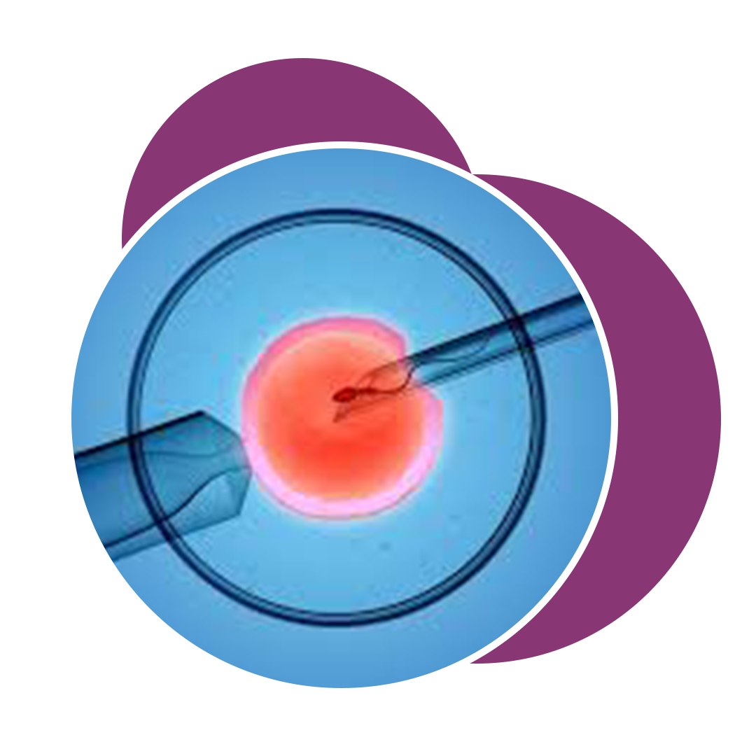 IUI Treatment In Ahmedabad