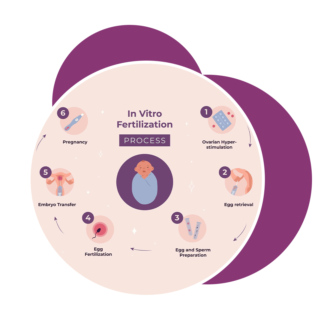 IVF Procedure